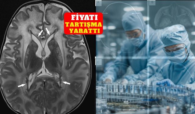 Alexander beyin hastalığı için ilk ilaç onaylandı! Fiyatı 285 bin dolar