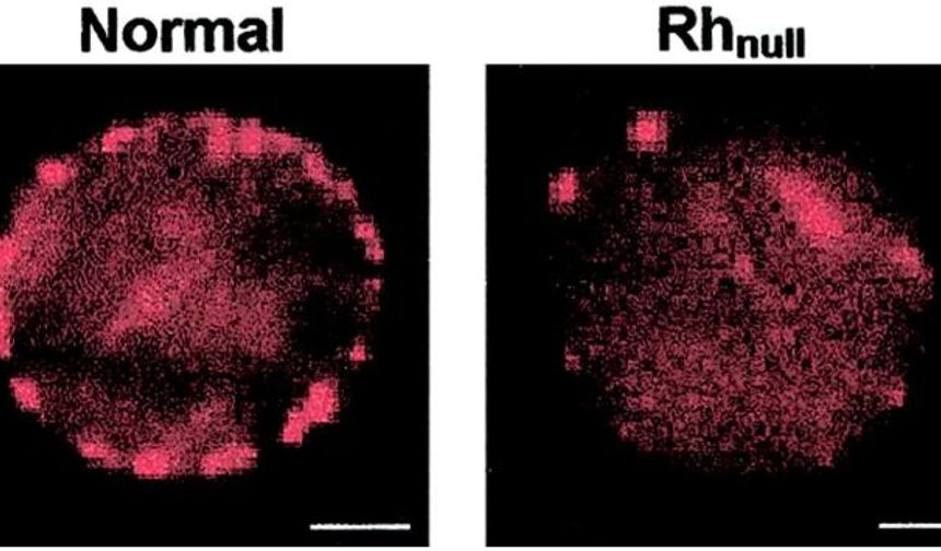 Altın gibi! Dünyada sadece 50 kişide var