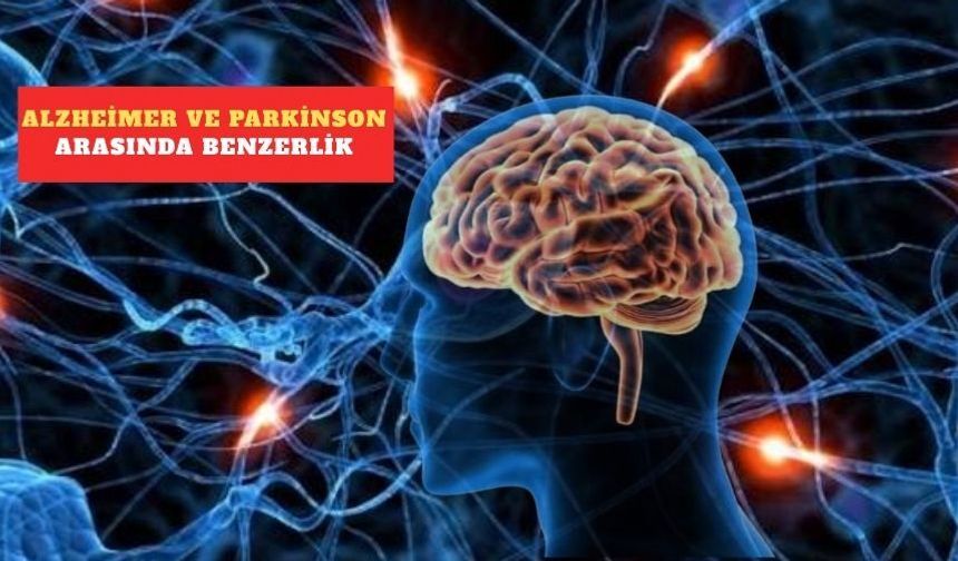 6,3 milyon hücre çekirdeği incelendi! Beyin hastalıklarının ortak izleri bulundu
